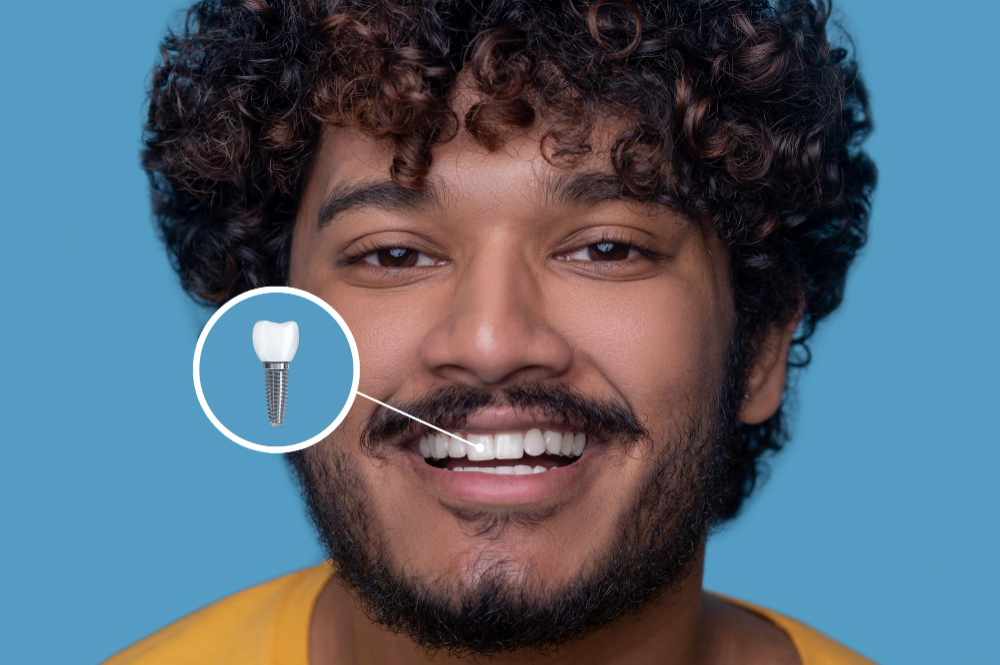 Implant Restoration